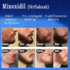 Minoxidil férfi - 6 darab